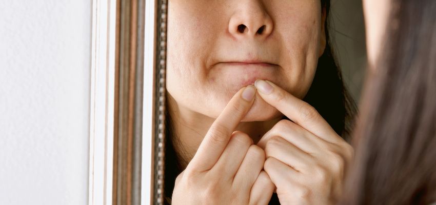 The woman wants to get rid of the sebaceous filaments on her face.